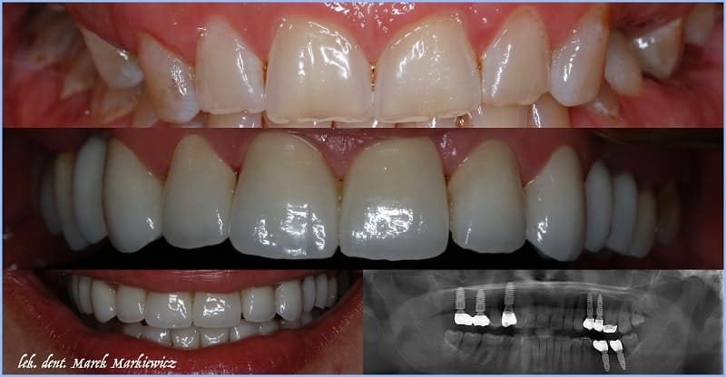 Zdjęcia panoramiczne cyfrowe