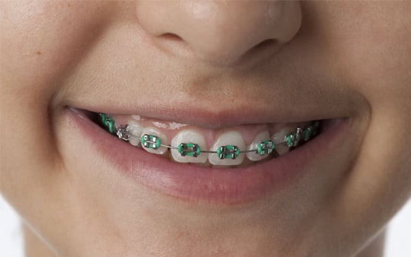 Najlepszy ortodonta – jakie powinien mieć cechy