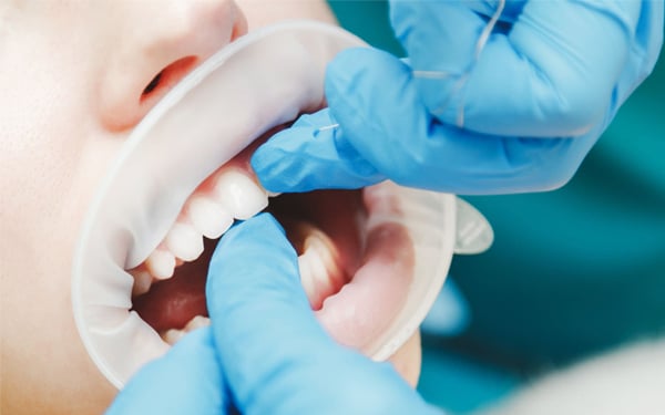 Czy&nbsp;wybielanie zębów boli?