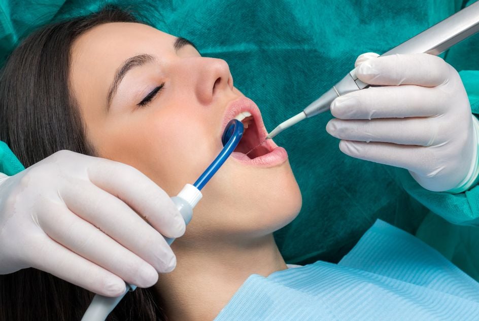 higienizacja implantów zębowych