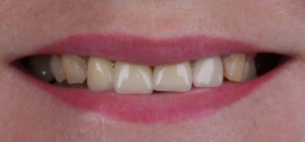 5.3