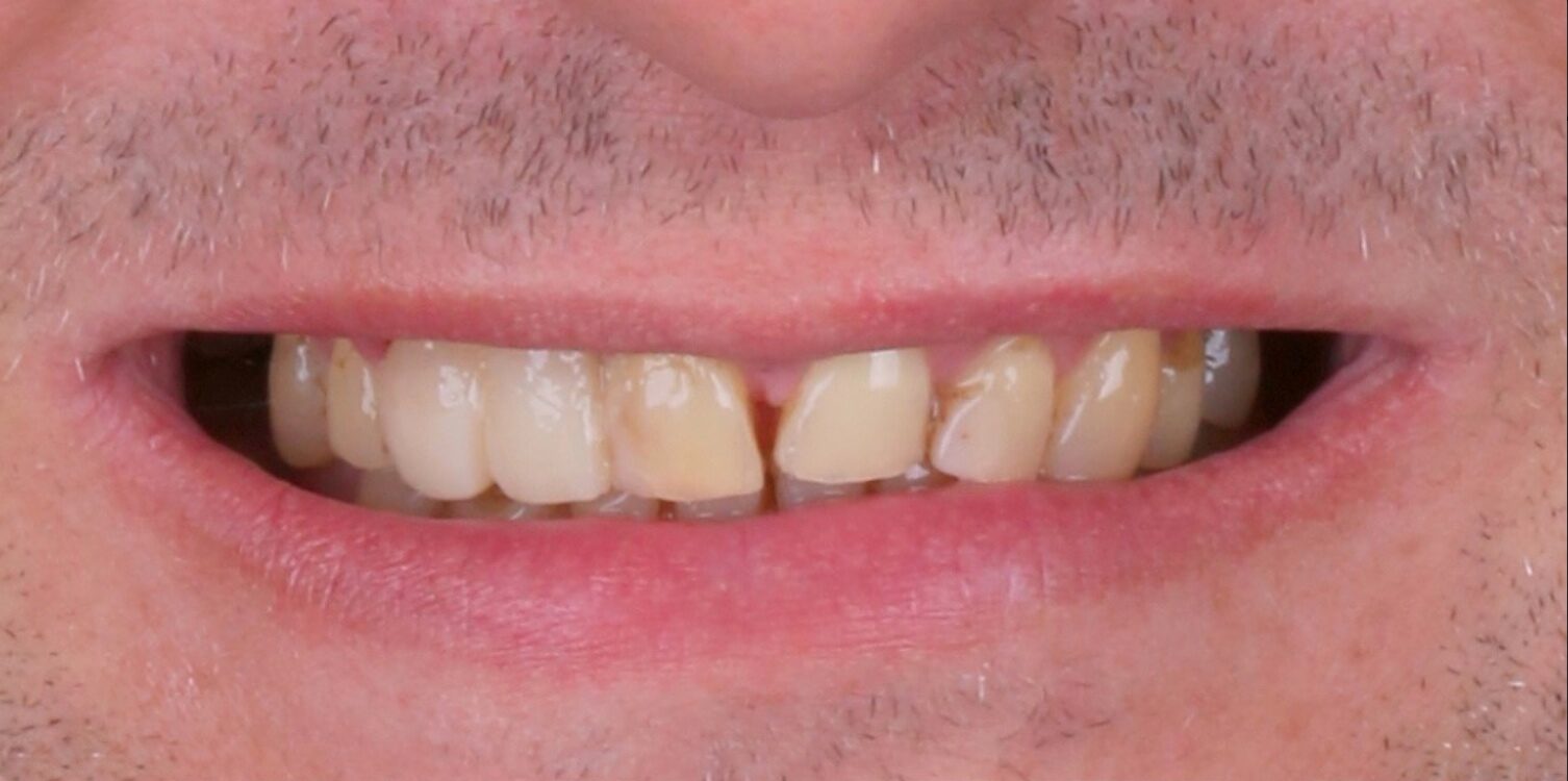7.2