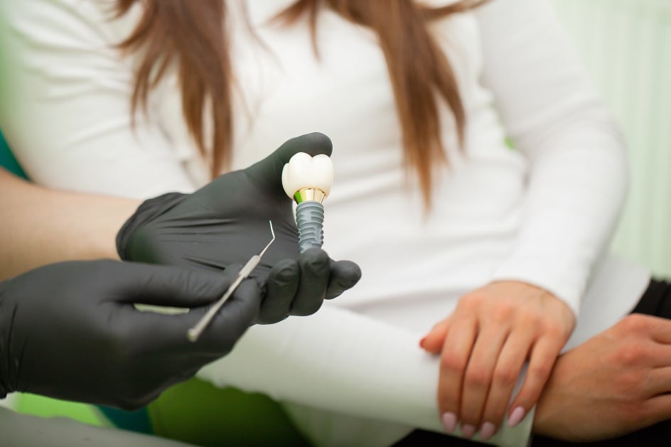 Cleaning Dental Implants