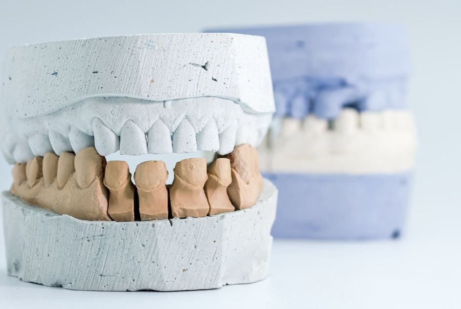 Leczenie protetyczne Gdańsk